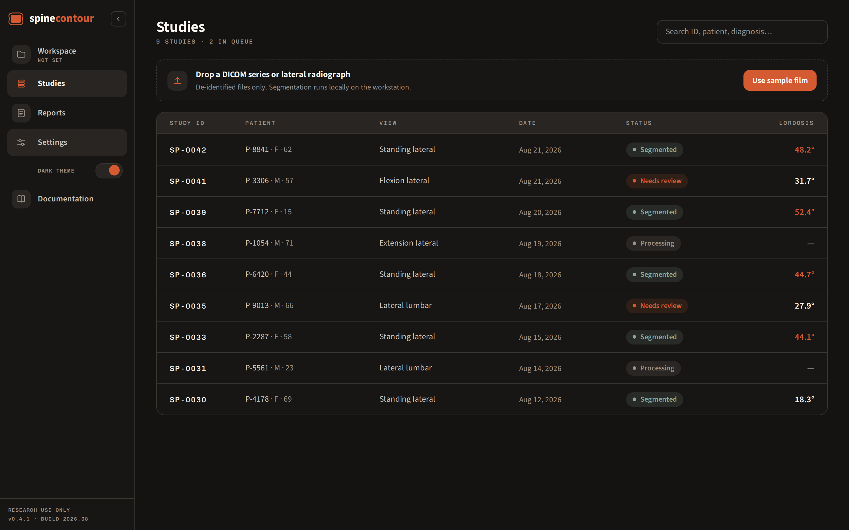 Studies screen in dark mode: searchable table of studies with view, status and lordosis columns